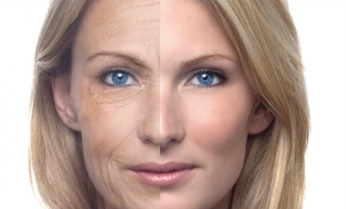 البشرة قبل وبعد العلاج بالتقنيات التجميلية الحديثة البشرة قبل وبعد العلاج بالتقنيات التجميلية الحديثة