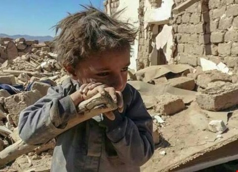 اليمن: مجاعة وفقر وكوليرا اليمن: مجاعة وفقر وكوليرا