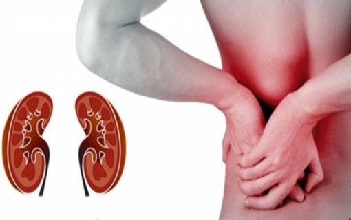 عدد الكلى المُتبرَّع بها سنوياً لا تكفي عدد المرضى المصابين بمرض القصور الكلوي الكليّ أو المزمن عدد الكلى المُتبرَّع بها سنوياً لا تكفي عدد المرضى المصابين بمرض القصور الكلوي الكليّ أو المزمن