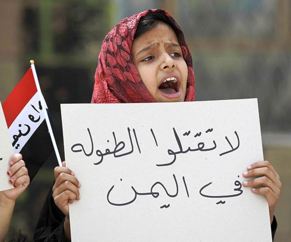 أطفال اليمن تحت نيران القنابل العنقودية أطفال اليمن تحت نيران القنابل العنقودية