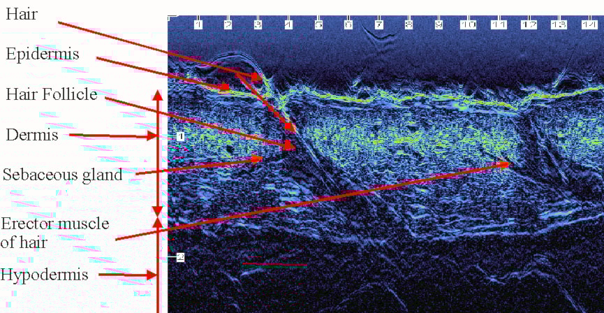 كيف تعمل الموجات الصوتية بجهاز ألـ Ultrasound كيف تعمل الموجات الصوتية بجهاز ألـ Ultrasound