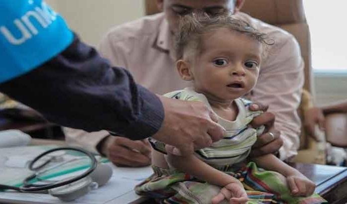 الأمم المتحدة تدق ناقوس الخطر.. اليمن يواجه المجاعة الأمم المتحدة تدق ناقوس الخطر.. اليمن يواجه المجاعة