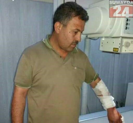أحد جرحى التفجير في الحافلة أحد جرحى التفجير في الحافلة