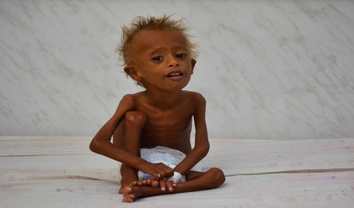 مسؤول أممي: 14 مليون يمني على حافة المجاعة... قريباً مسؤول أممي: 14 مليون يمني على حافة المجاعة... قريباً
