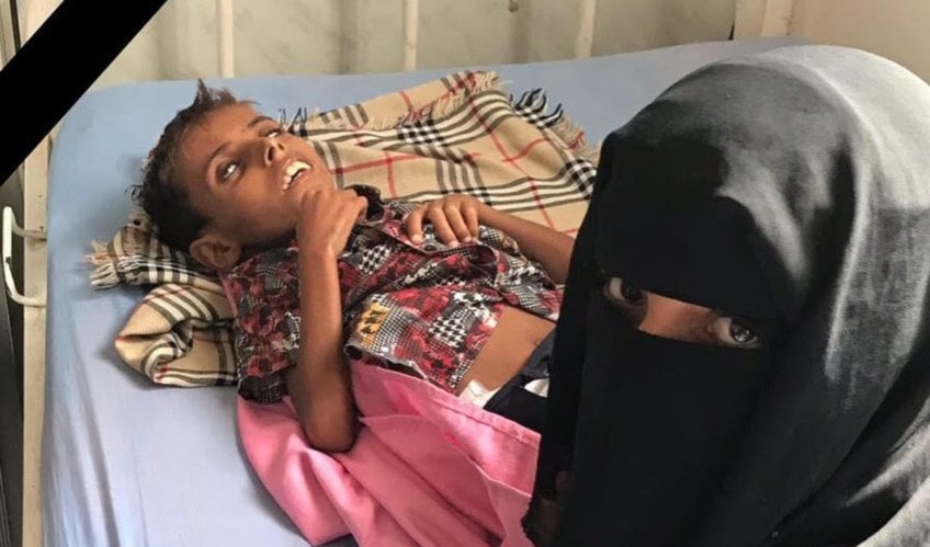 صورة نشرتها اليونيسف للطفل آدم وهو في المستشفى صورة نشرتها اليونيسف للطفل آدم وهو في المستشفى