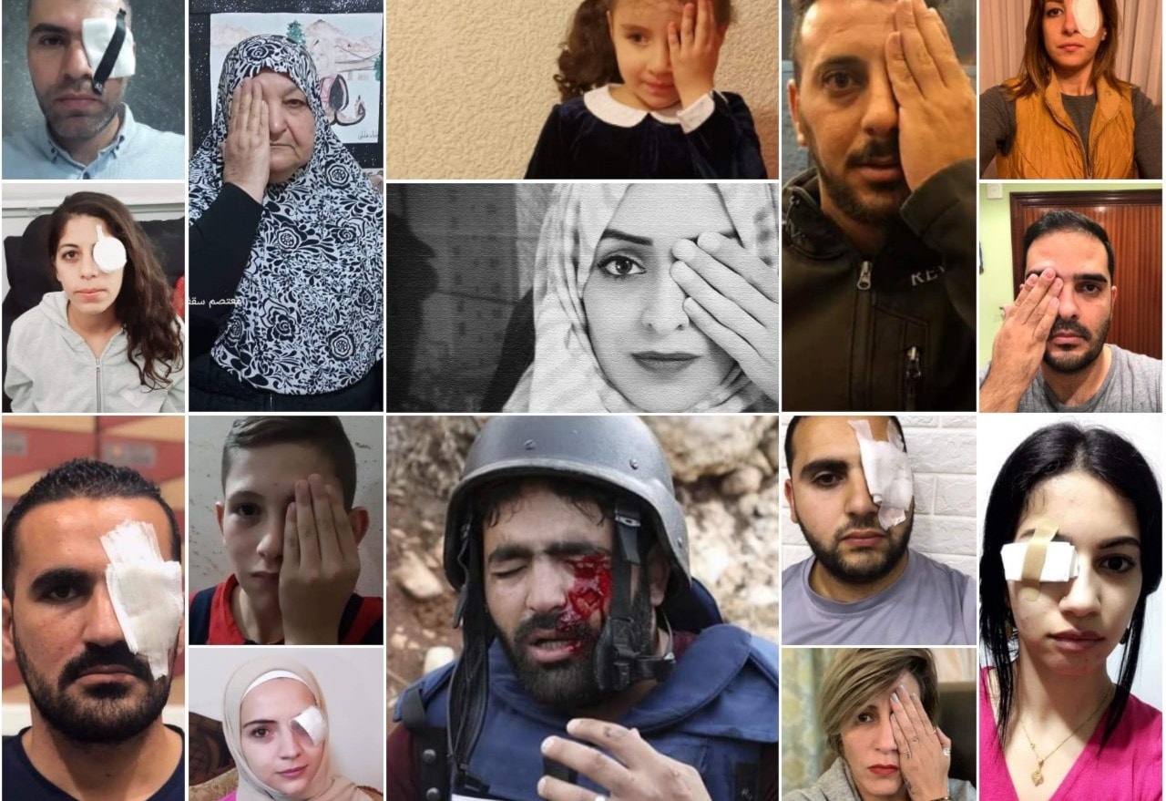 الصحفيون أكدوا أنّ كل الانتهاكات بحقهم لن تمنعهم من كشف جرائم الاحتلال الصحفيون أكدوا أنّ كل الانتهاكات بحقهم لن تمنعهم من كشف جرائم الاحتلال