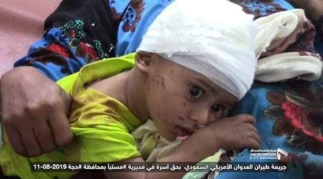 التحالف السعودي يرتكب مجزرة مروعة في حجة اليمنية التحالف السعودي يرتكب مجزرة مروعة في حجة اليمنية