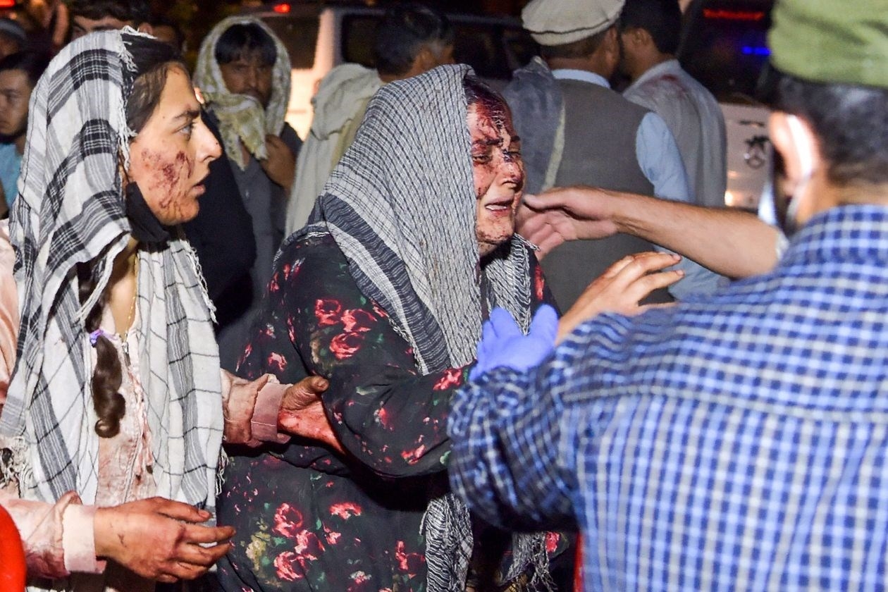 Wounded women arrive at a hospital for treatment after two blasts in Kabul on August 26, 2021 | AFP